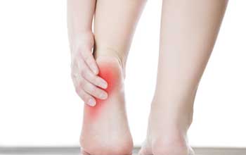 Plantar Fasciitis